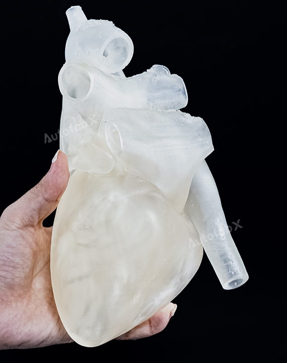 Translucent Resin